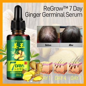 Ginger Hair Oil Nutrient Hair Solution | Fast Natural Hair Loss Treatment Hair Care (30ml)