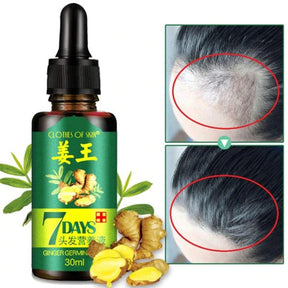 Ginger Hair Oil Nutrient Hair Solution | Fast Natural Hair Loss Treatment Hair Care (30ml)